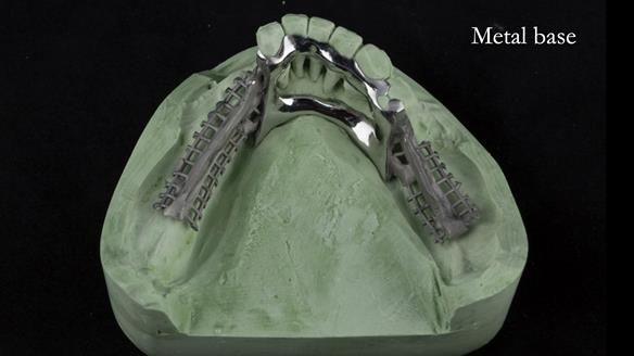 Ken – going downhill, first class