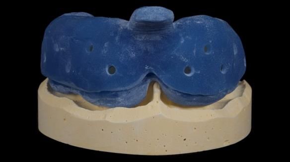 Newsletter 79 – Creating a wonderful smile and changing a life.