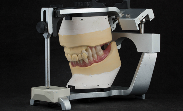 Figure 26 Mounted casts with finished dentures on the articulator. Schottlander Enigmalife denture teeth and Dental D clasps