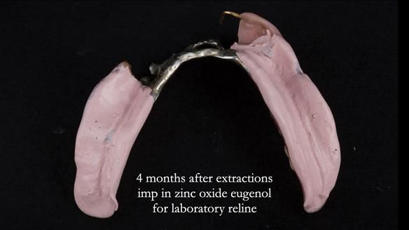 Ken – going downhill, first class