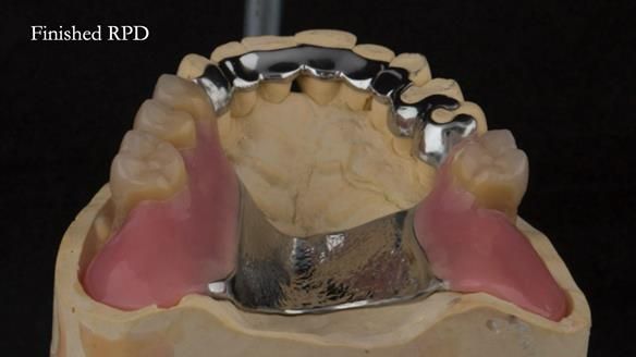 Ken – going downhill, first class