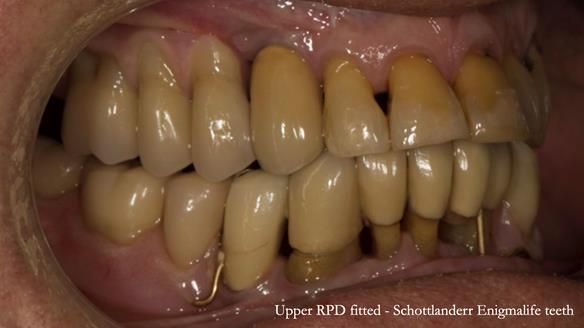 Ken – going downhill, first class