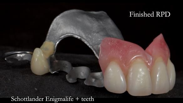 Newsletter 81 - Pam’s Story — how a partial denture changed her life (+ live walkthrough this Thursday)