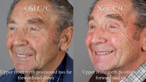 Newsletter 50 Special edition Complete Dentures FULL PROTOCOL