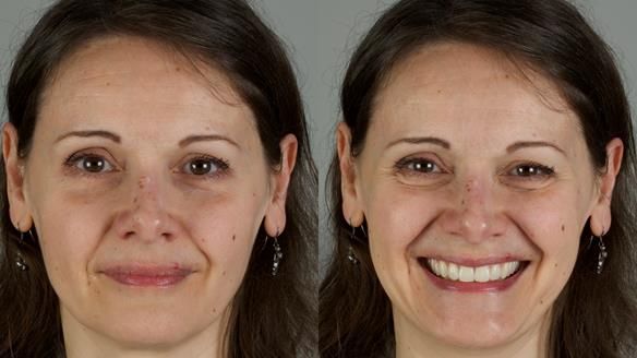 Newsletter 79 – Creating a wonderful smile and changing a life.