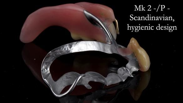 Newsletter 54 case presentation upper complete denture and lower Scandinavian designed hygienic partial denture for David