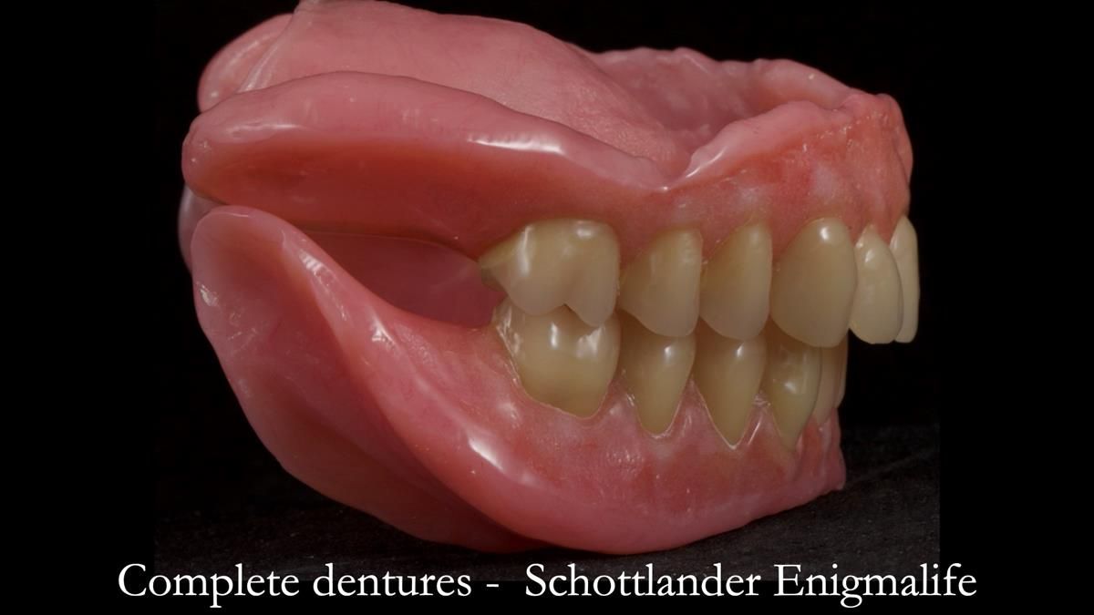 Fin’s Newsletter 88 — Complete dentures - full protocol… he rearranged his own teeth!