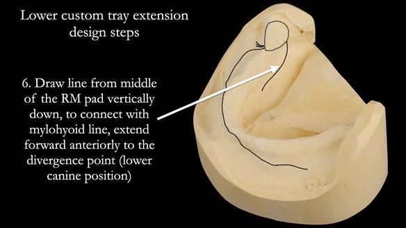 Newsletter 50 Special edition Complete Dentures FULL PROTOCOL