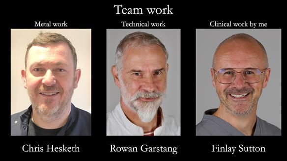 Newsletter 76: Jackie’s case – Telescopic overdenture & precision RPD (the tricky truth!)