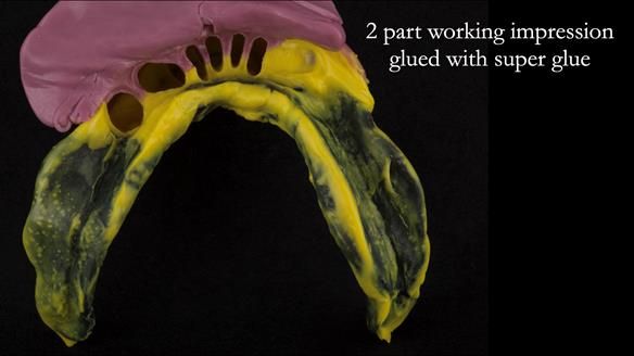 Ken – going downhill, first class