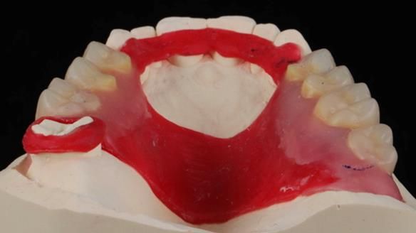 Finlay's Newsletter 60 Sylvia's upper Kennedy Class 2 Mod 1 metal based upper RPD