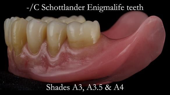 Newsletter 50 Special edition Complete Dentures FULL PROTOCOL