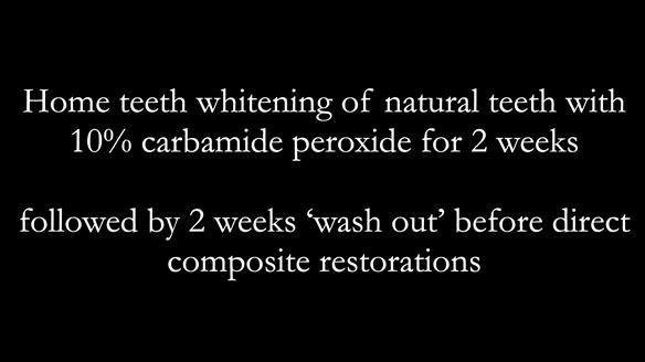 Newsletter 52 Managing Jo’s failing dentition with extractions and Mk 1/Mk 2 complete upper dentures and lower partial dentures FULL PROTOCOL