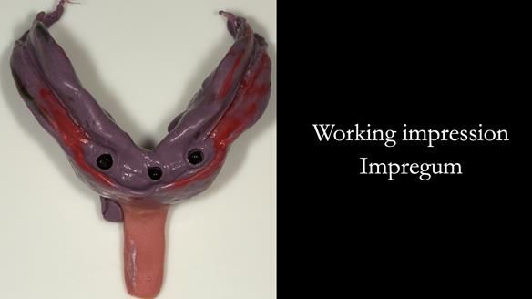 Close fitting tray - where the tray shows through the impression material is not a problem because the tray hs been made to fit the accurate primary cast.