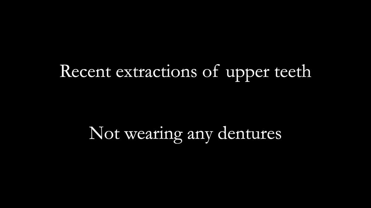 Fin’s Newsletter 88 — Complete dentures - full protocol… he rearranged his own teeth!