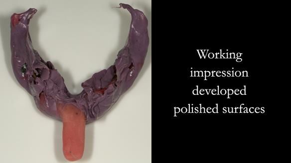 Top surface of working impression - showing developed polished surfaces to be preserved in the denture