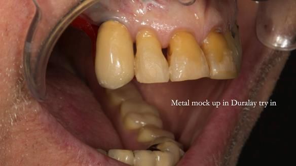 Ken – going downhill, first class