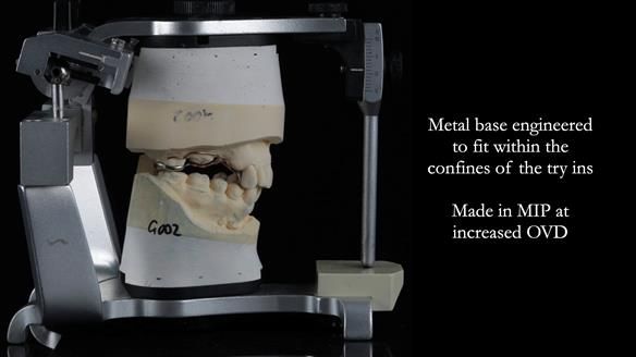 Finlay's Newsletter 60 Sylvia's upper Kennedy Class 2 Mod 1 metal based upper RPD