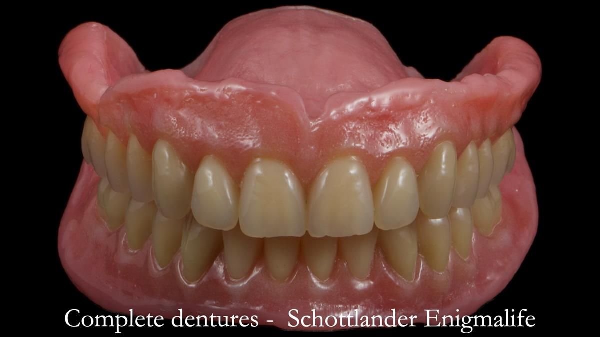 Fin’s Newsletter 88 — Complete dentures - full protocol… he rearranged his own teeth!