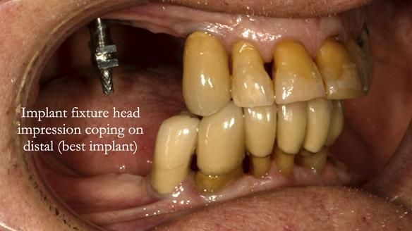 Ken – going downhill, first class