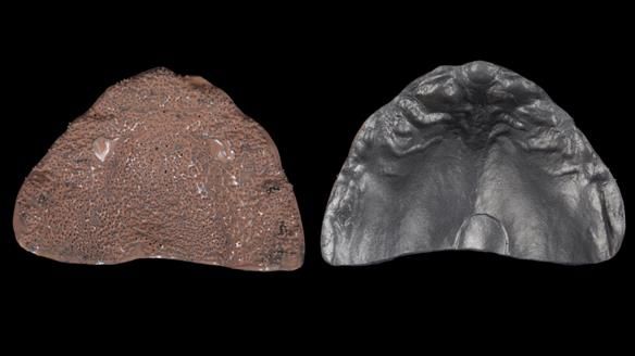 Newsletter 79 – Creating a wonderful smile and changing a life.