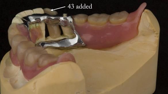 Ken – going downhill, first class