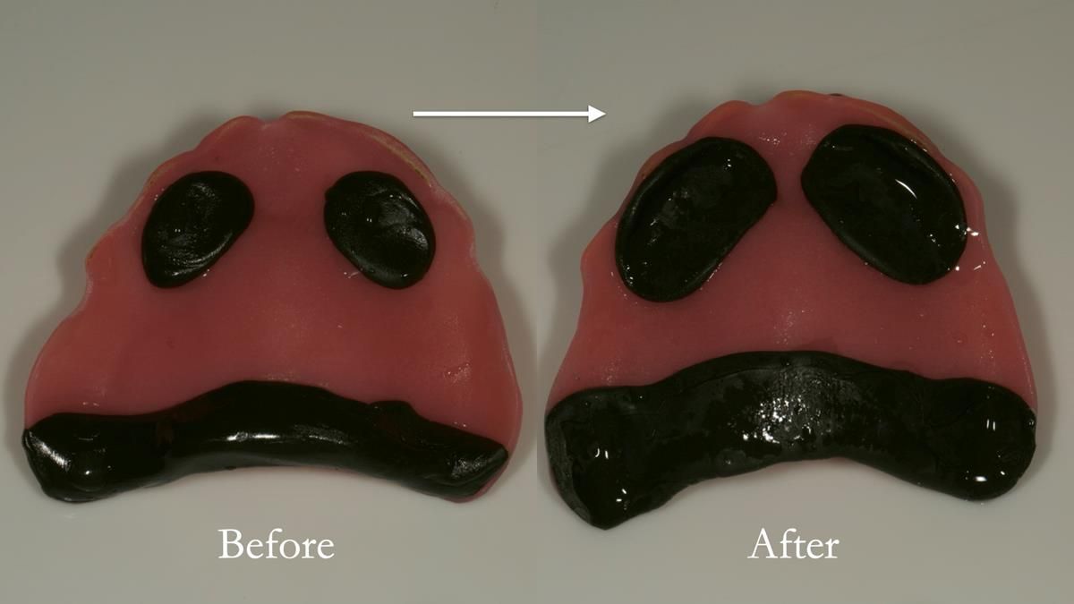 Newsletter 87 – Father Peter: A Partial Denture that needed Minor Miracle