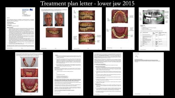 Ken – going downhill, first class
