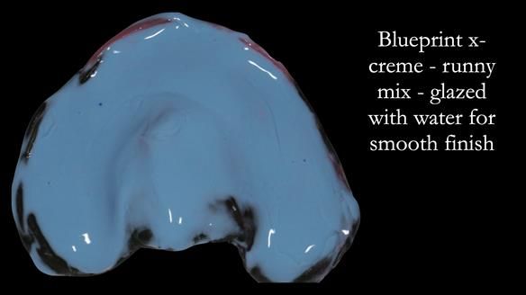 Newsletter 52 Managing Jo’s failing dentition with extractions and Mk 1/Mk 2 complete upper dentures and lower partial dentures FULL PROTOCOL
