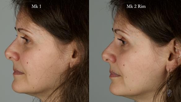 Newsletter 79 – Creating a wonderful smile and changing a life.