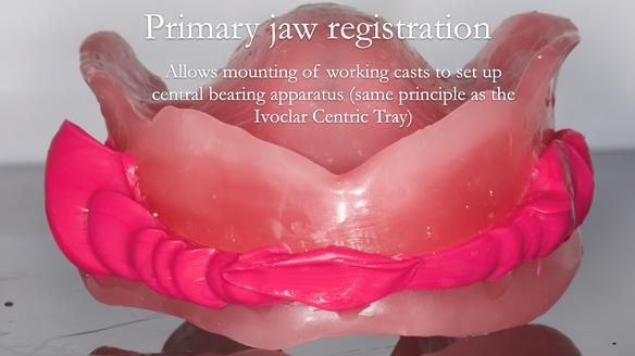 Newsletter 53 showing the making and fitting of ultra life-like dentures for Valena