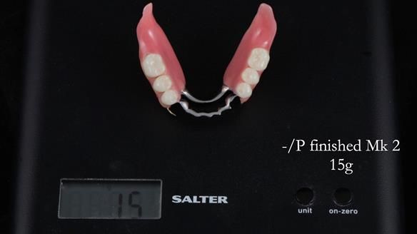 Newsletter 52 Managing Jo’s failing dentition with extractions and Mk 1/Mk 2 complete upper dentures and lower partial dentures FULL PROTOCOL