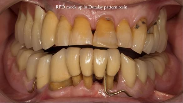 Ken – going downhill, first class