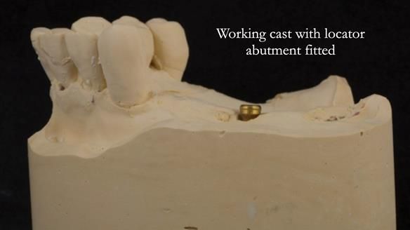 Ken – going downhill, first class