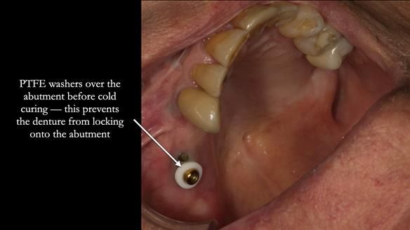 Ken – going downhill, first class