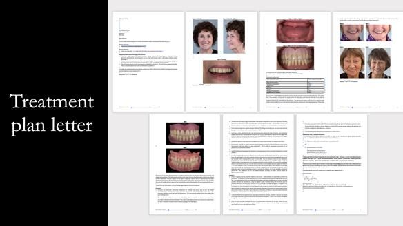 Newsletter 75: Marion’s case - Step-by-step complete denture workflow
