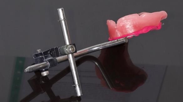 Newsletter 79 – Creating a wonderful smile and changing a life.