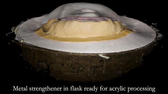 Newsletter 52 Managing Jo’s failing dentition with extractions and Mk 1/Mk 2 complete upper dentures and lower partial dentures FULL PROTOCOL