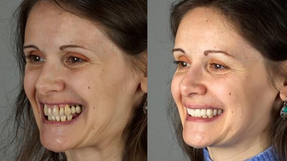 Newsletter 79 – Creating a wonderful smile and changing a life.