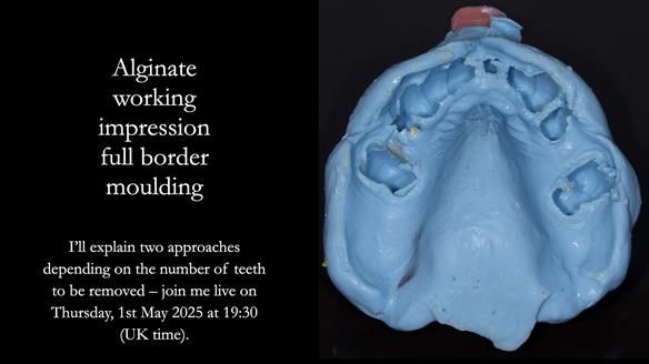 Newsletter 77: Jeremy’s case – immediate complete upper denture