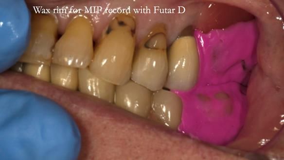 Ken – going downhill, first class