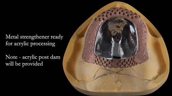 Newsletter 50 Special edition Complete Dentures FULL PROTOCOL
