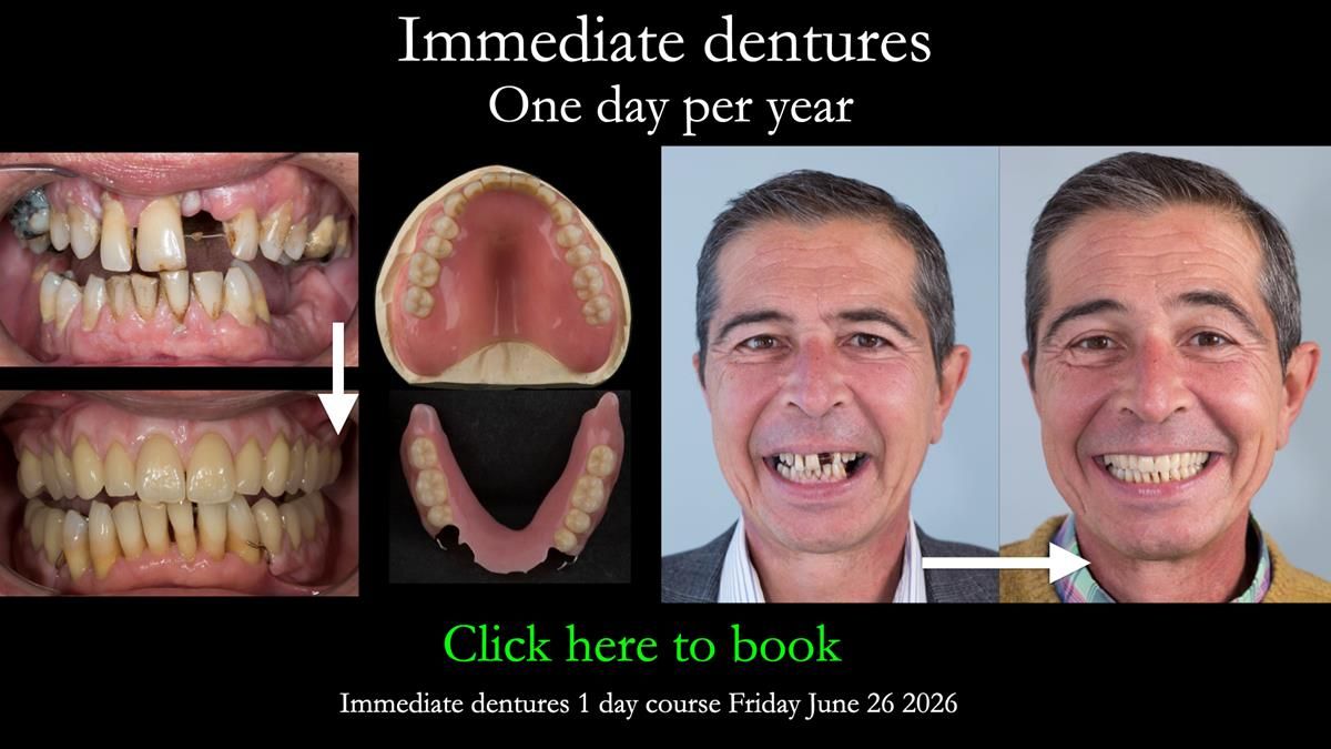 Ken – going downhill, first class