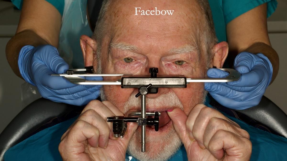 Newsletter 87 – Father Peter: A Partial Denture that needed Minor Miracle