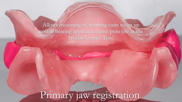 Newsletter 53 showing the making and fitting of ultra life-like dentures for Valena