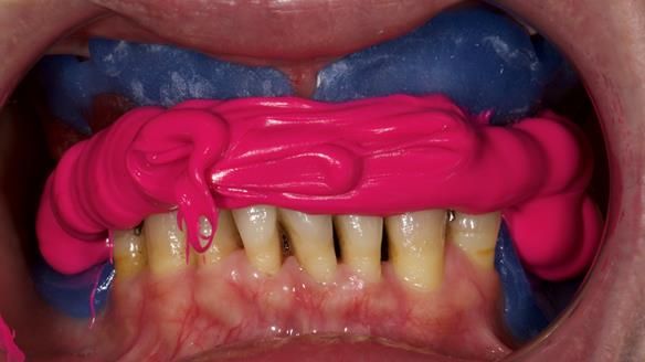 Newsletter 79 – Creating a wonderful smile and changing a life.