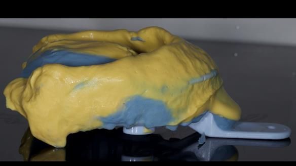 Newsletter 79 – Creating a wonderful smile and changing a life.