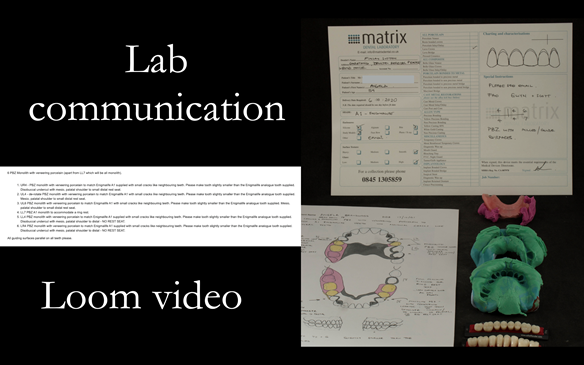 Figure 48 Communication with the laboratory for the porcelain fused to zirconia crown crowns. To mimic the Schottlander Enigmalife teeth in colour. To incorporate guiding surfaces, ledges and rest seats for the metal based partial dentures. Loom video ema