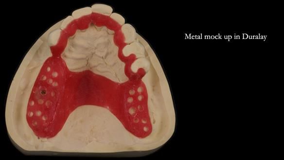 Ken – going downhill, first class