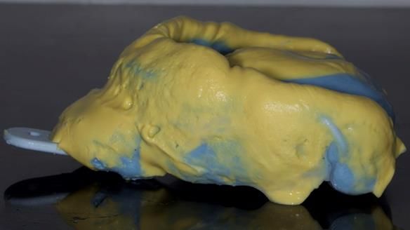 Newsletter 79 – Creating a wonderful smile and changing a life.